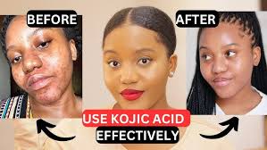 lemon, turmeric & kojic acid soap